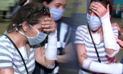 Eski erkek arkadaşının yüzüne kezzap atmıştı! Yeni gelişme…