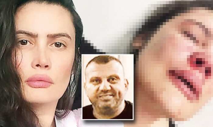 Hiçbir canlı bunu yapmaz! Derya son anda kurtuldu, kızı Twitter’da yardım istedi